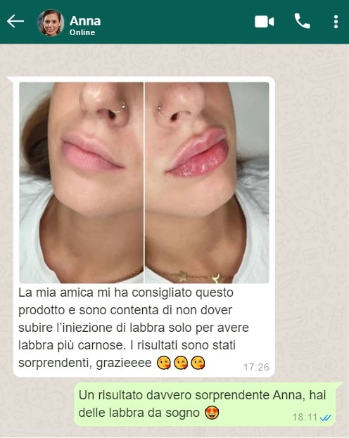 crema rimpolpante labbra 5