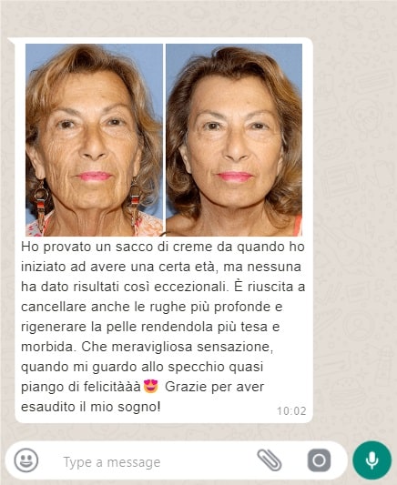 Crema antirughe e occhiaie 3