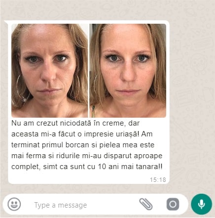 crema antirid si cearcane 4