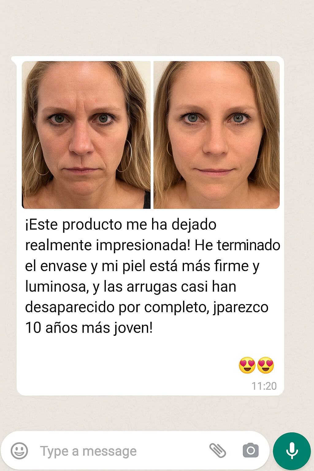crema antiarrugas oro 4