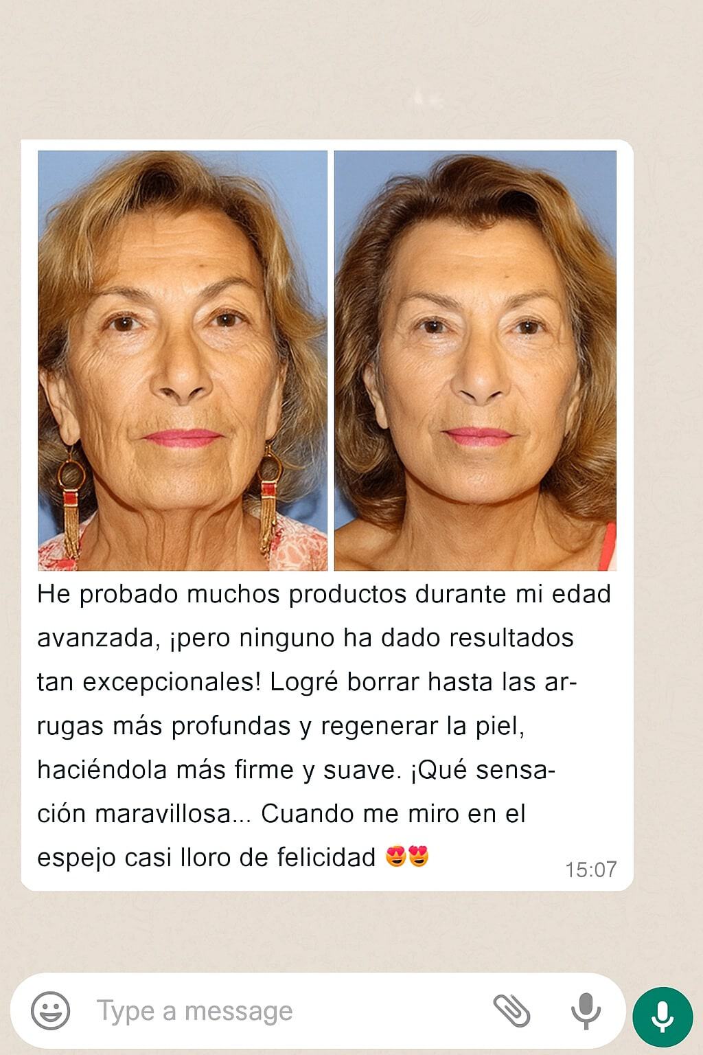 crema antiarrugas oro 5