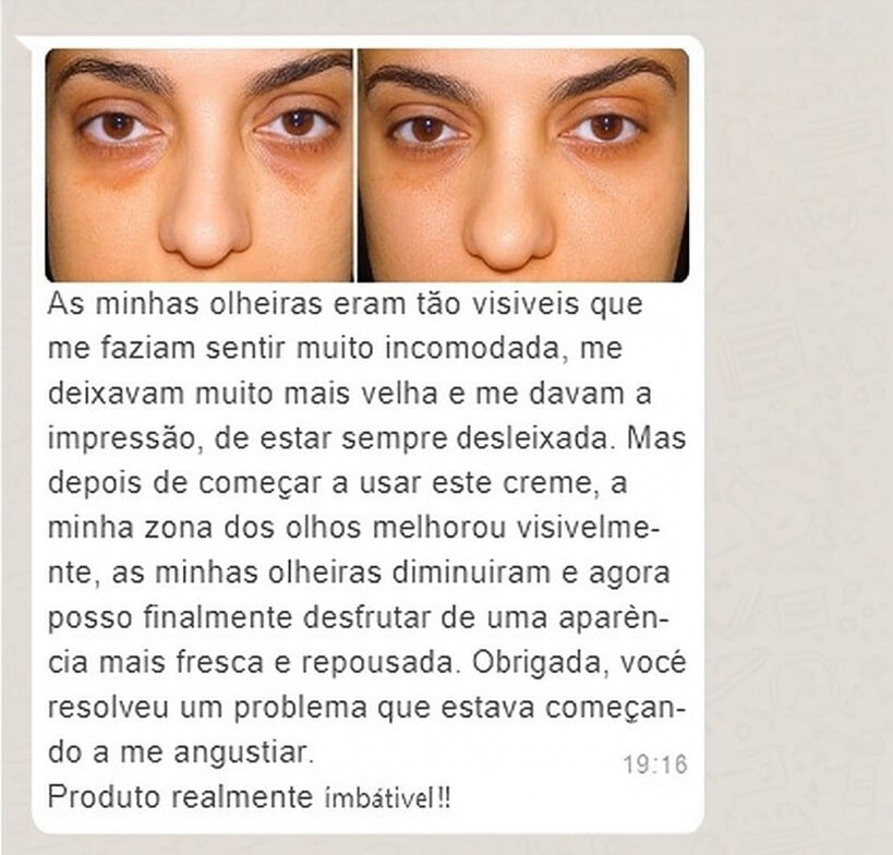 Antes e depois do creme antirrugas para olheiras e bolsas sob os olhos.