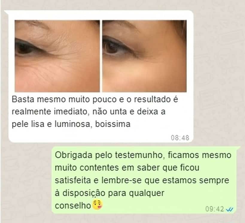 Prima e dopo l'uso di crema antirughe per borse e occhiaie.