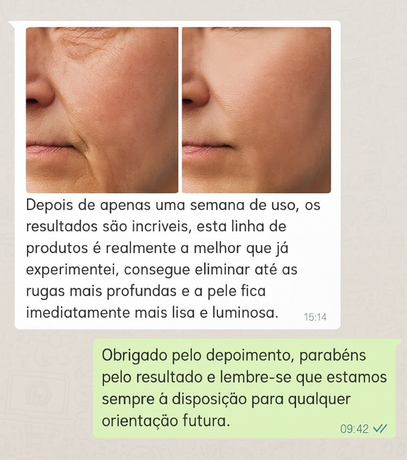 Prima e dopo trattamento anti-rughe e borse sotto gli occhi.