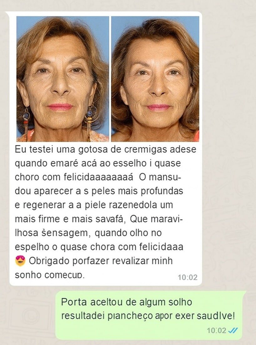Duas fotos de uma mulher idosa antes e depois do uso do creme.