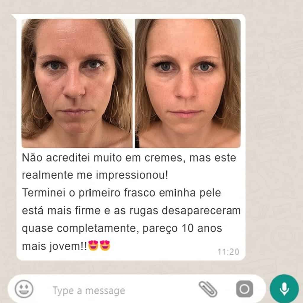 Prima e dopo l'uso della crema antirughe per borse e occhiaie.